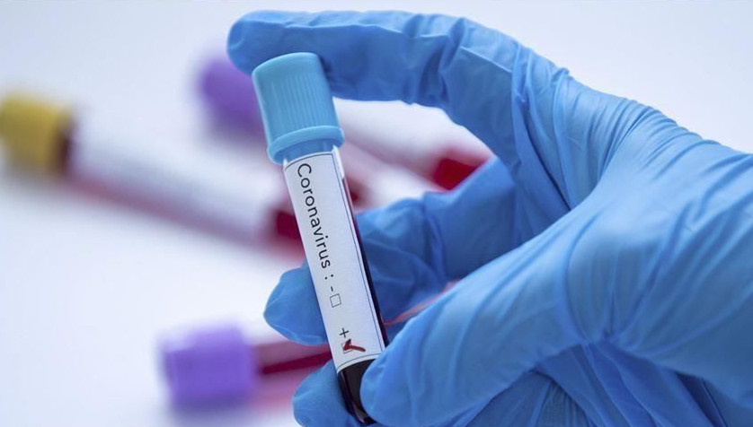 Koronavırýs qaıta kúsheıdi