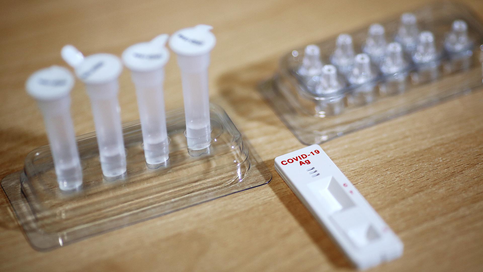 Koronavırýsqa qarsy qandaǵy antıdenelerdi tekserý nege tıimsiz?