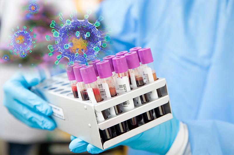 О́tken táýlikte Qazaqstanda 1953 adamnan koronavırýs anyqtaldy