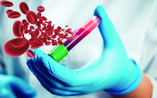 Leıkemııany jeńýge siz de  kómektese alasyz