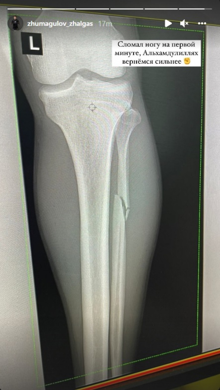 Jalǵas Jumaǵulov sońǵy jekpe-jekte aıaǵyn syndyryp alǵan