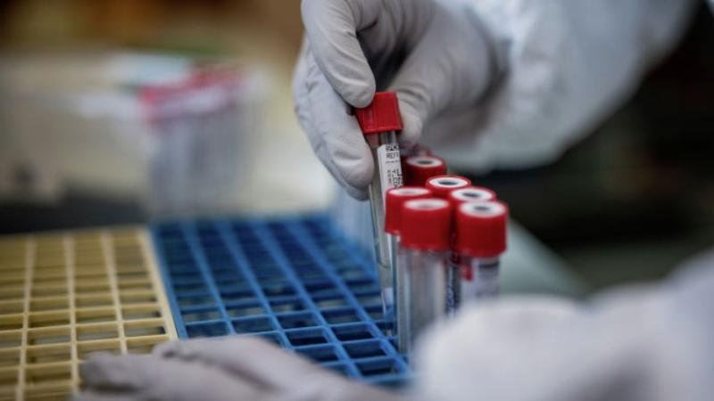 О́tken táýlikte 3231 adamnan koronavırýs anyqtaldy