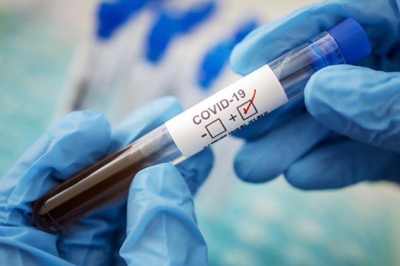 О́tken táýlikte 847 adamnan koronavırýs anyqtaldy