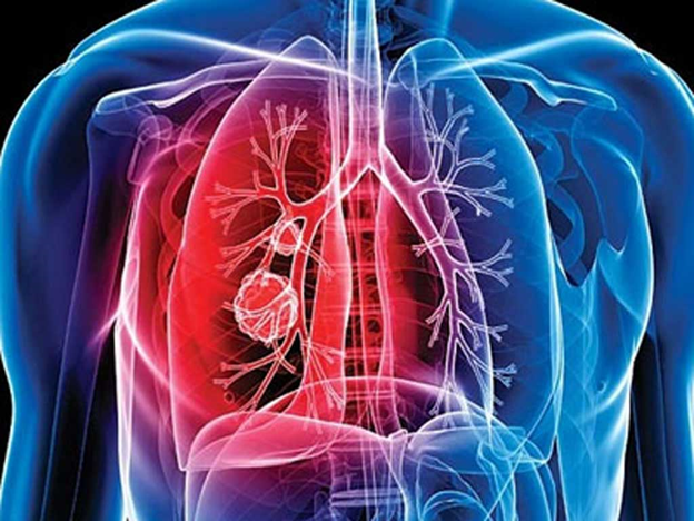 Týberkýlezge shaldyqqandar 2,3 esege tómendegen