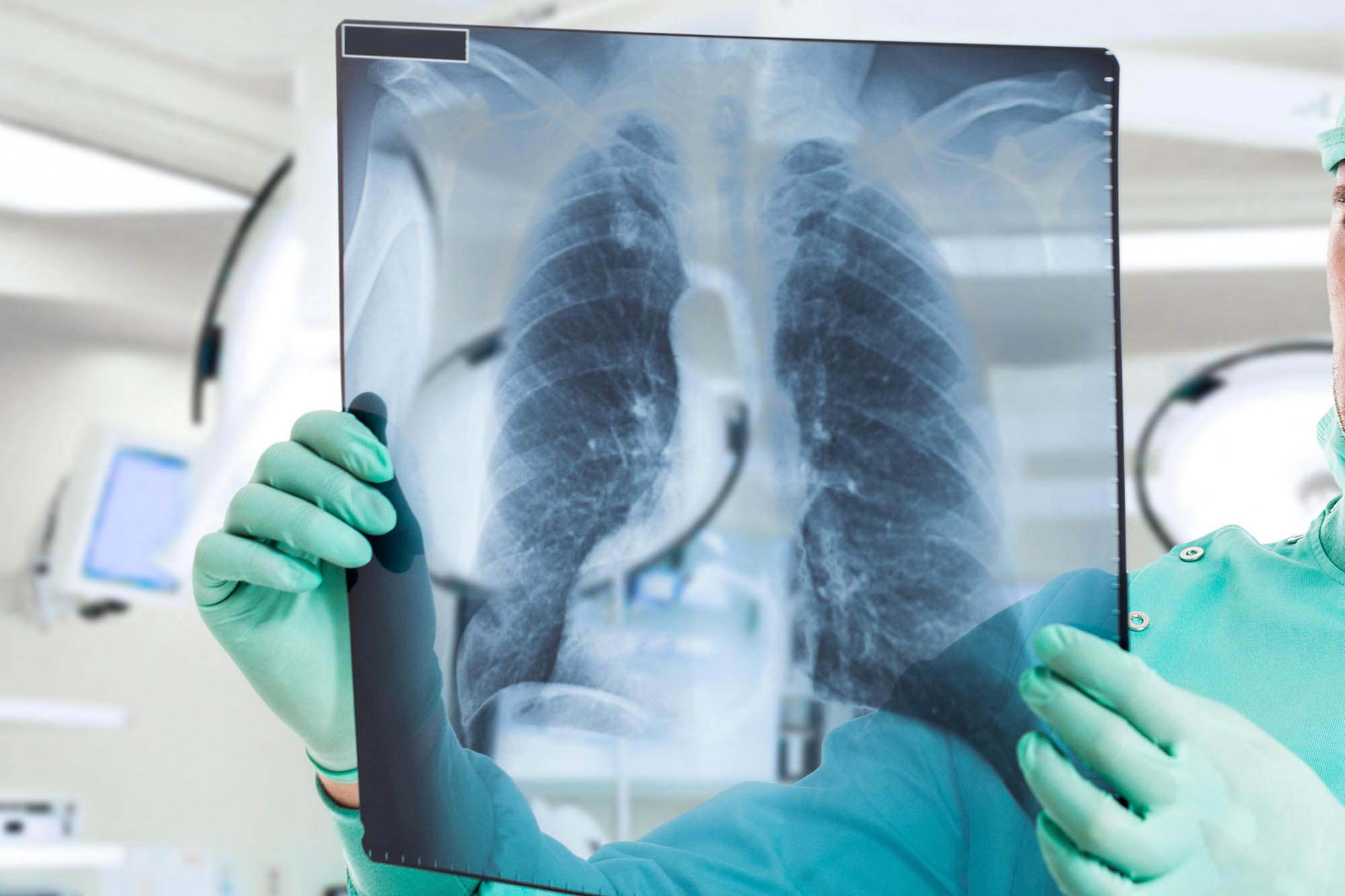 16 adam aýrýynan aıyǵyp shyqty