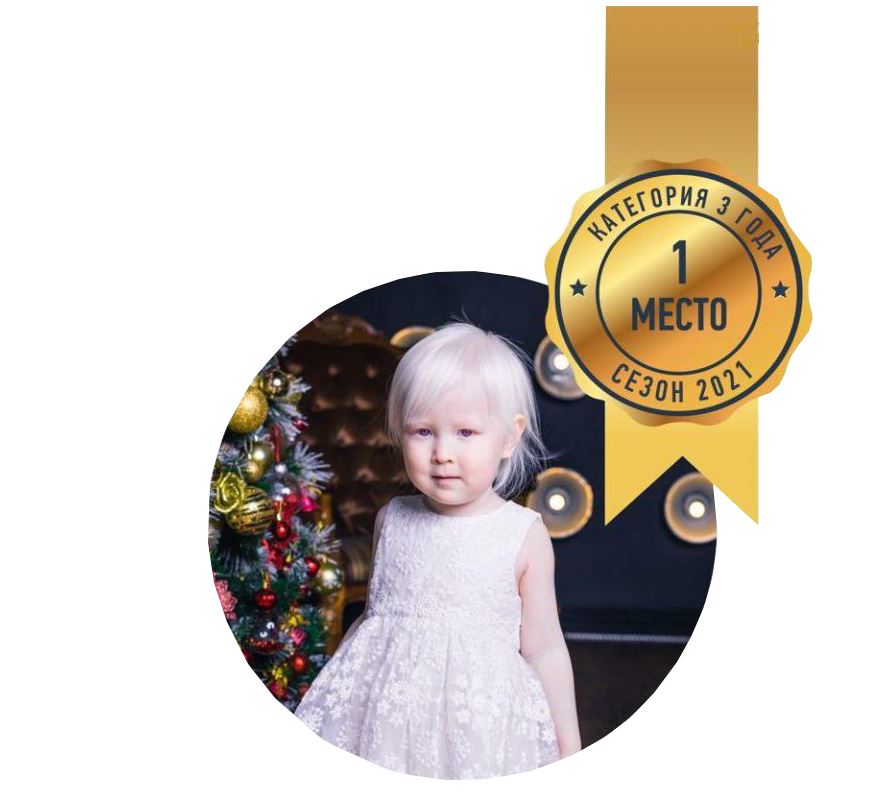 Atyraýdyń kishkentaı albınosy