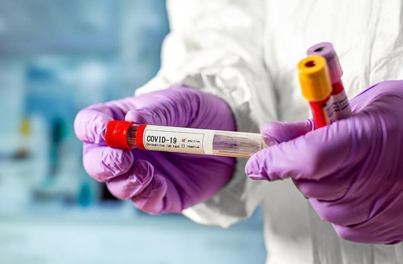 О́tken táýlikte 7 adamnan koronavırýs anyqtaldy