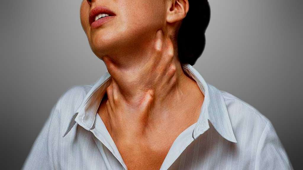 Tuqym qýalaıtyn angıonevrotıkalyq isiný qansha adamnan tabylýy múmkin?