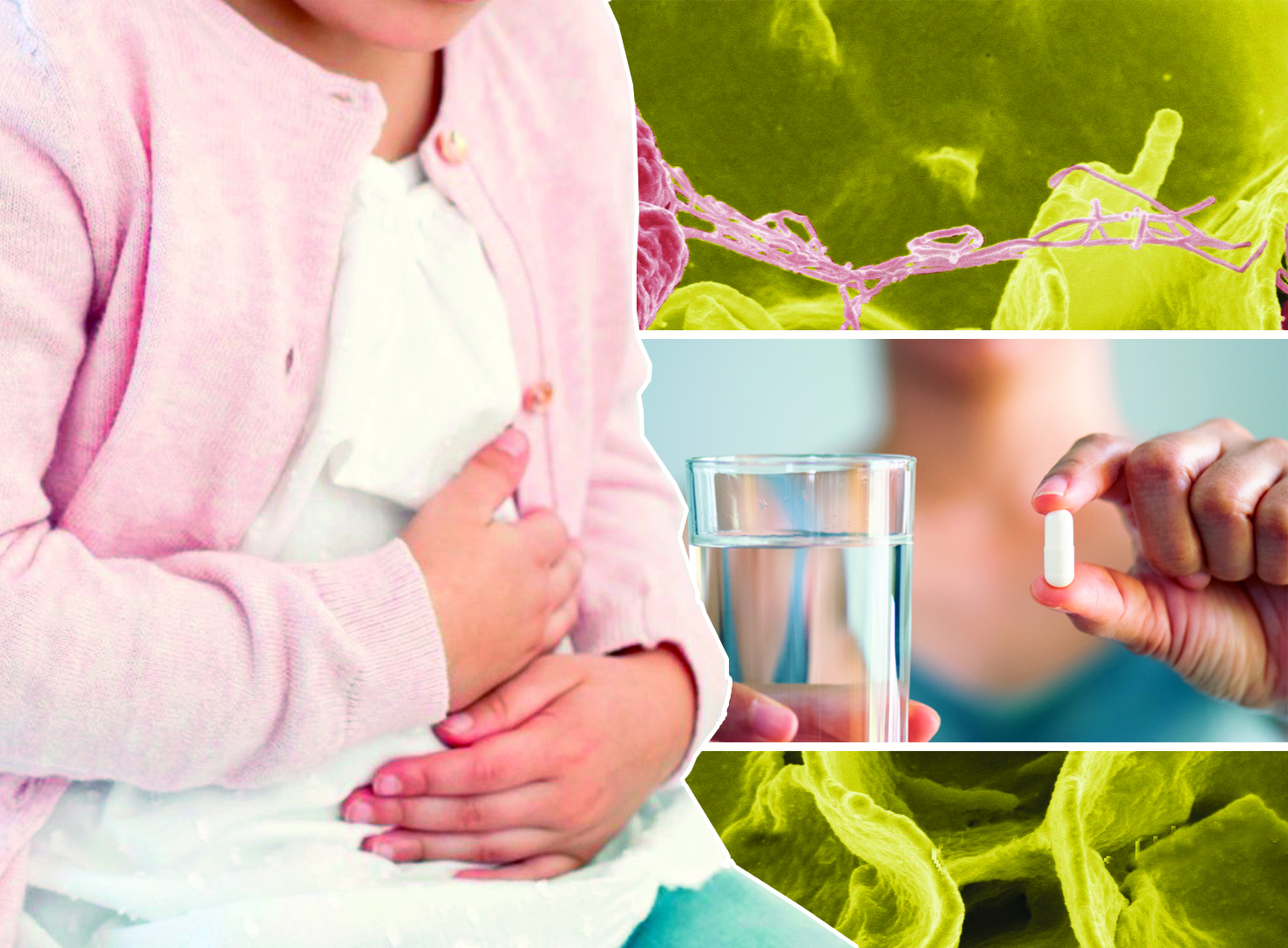 Jiti ishek aýrýlarynyń aldyn alýǵa shaqyrdy