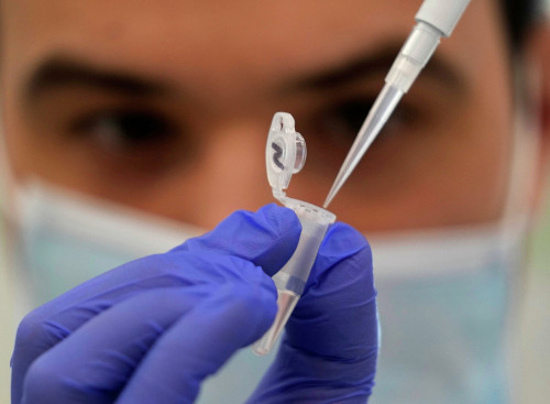 Álemde maımylshesheginiń 550-den astam jaǵdaıy tirkeldi - DDU