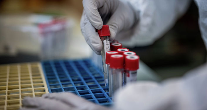 Epıdemııalyq ahýalmen tanysty