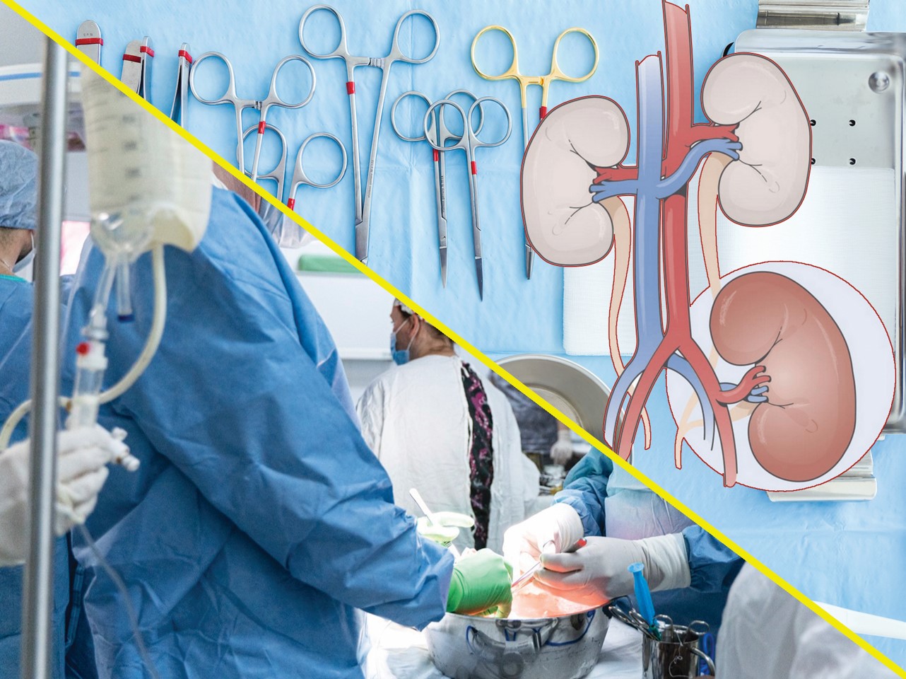 Transplantasııada donor tapshy