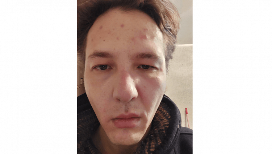 Aqparat mınıstri Danııar Moldabekovtiń oqıǵasyna baılanysty pikir bildirdi