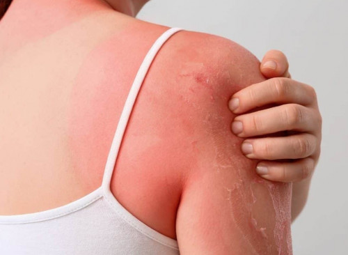 Kún sáýlesi adam terisine teris áser etedi - ǵalymdar