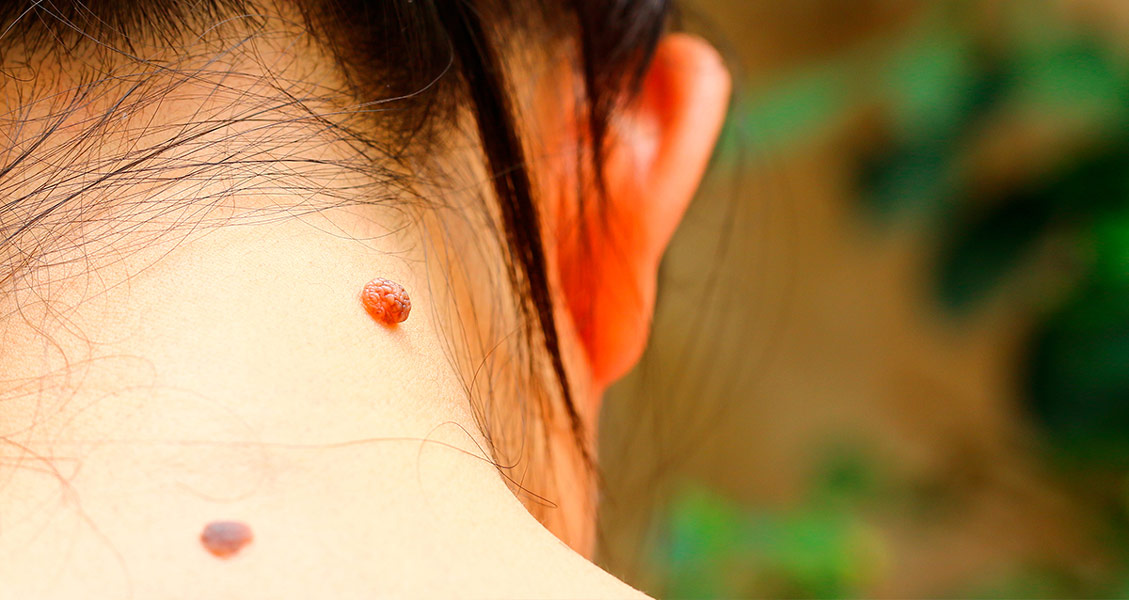 Qal astyndaǵy qater