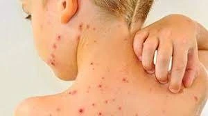 Juqpaly dert kúsheıip tur