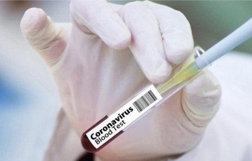 Eldegi koronavırýs boıynsha ahýal baqylaýda - mınıstrlik