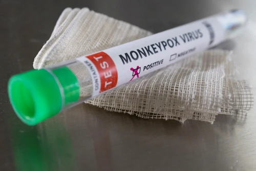 Astana áýejaıynda jolaýshydan maımyl sheshegi anyqtalǵany ras pa