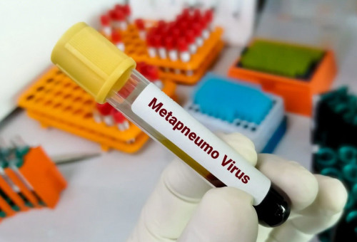 Batys Qazaqstan oblysynda eki bala metapnevmovırýsty juqtyrǵan