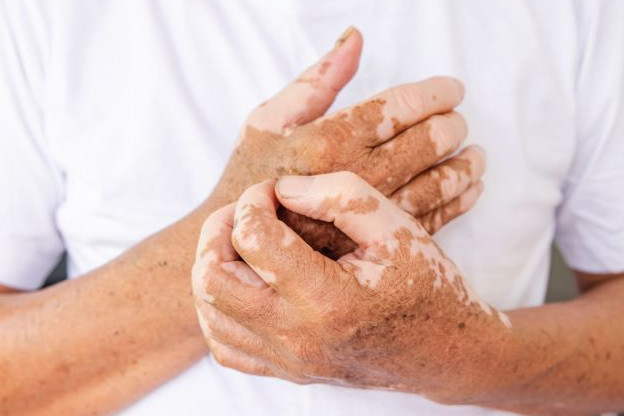 Elimizde sońǵy jeti jylda alapes aýrýy múlde anyqtalmaǵan