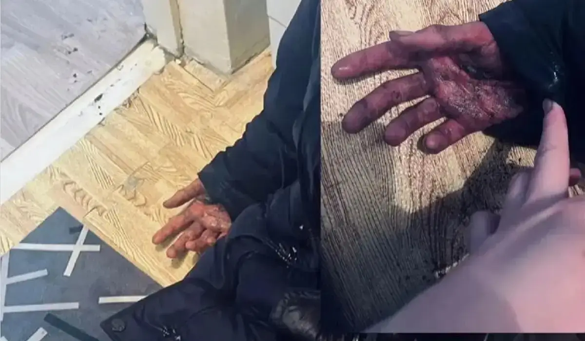 Qonaevta mektep oqýshysy antıseptık iship qoıǵan