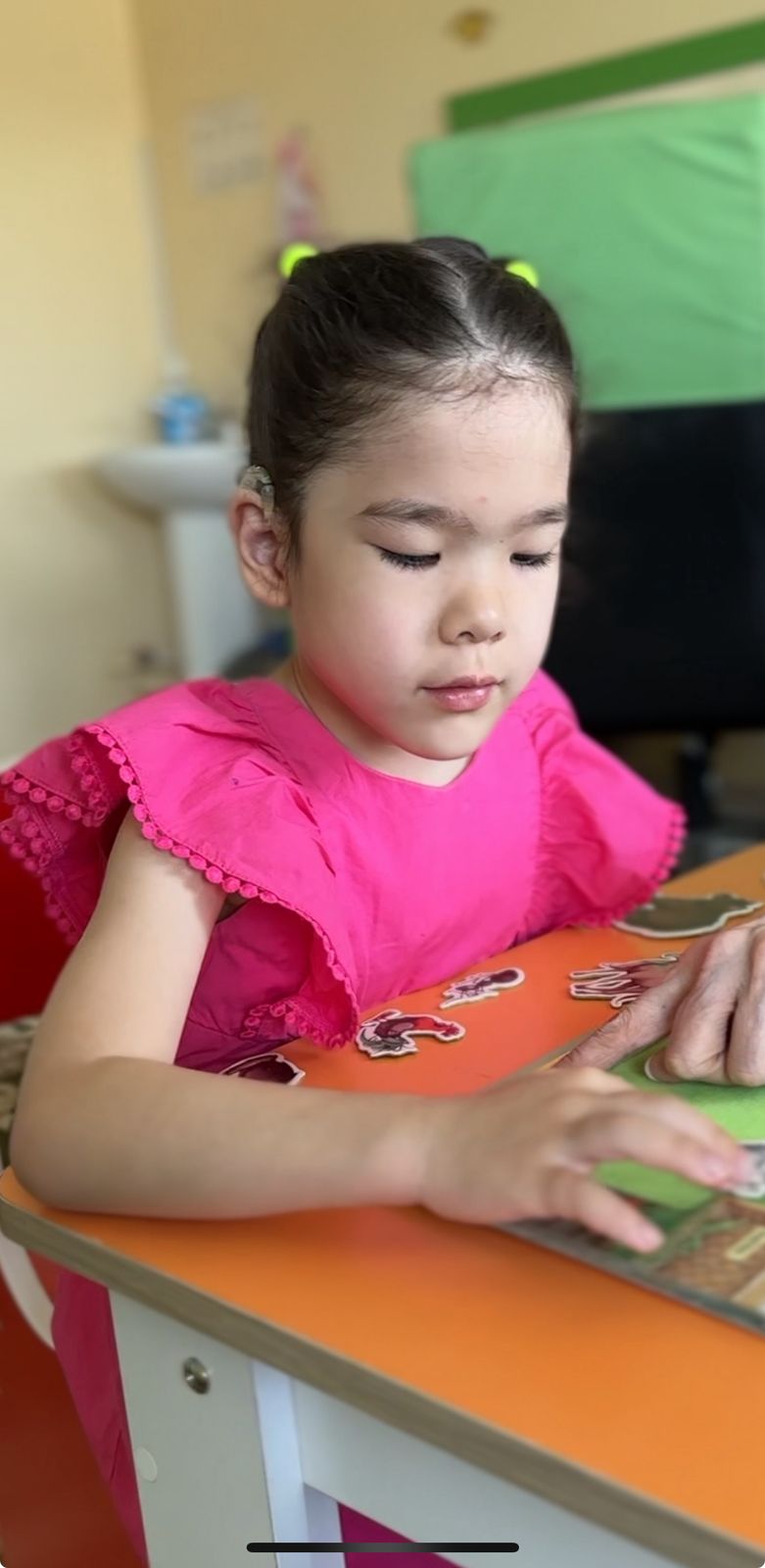 Qulaǵy estimeıtin balalarǵa  ımplant tegin ornatylady