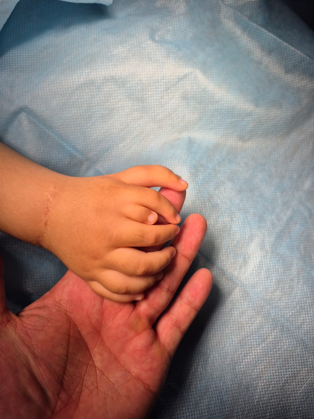 Almatyda 8 saýsaqpen týǵan balaǵa ota jasaldy