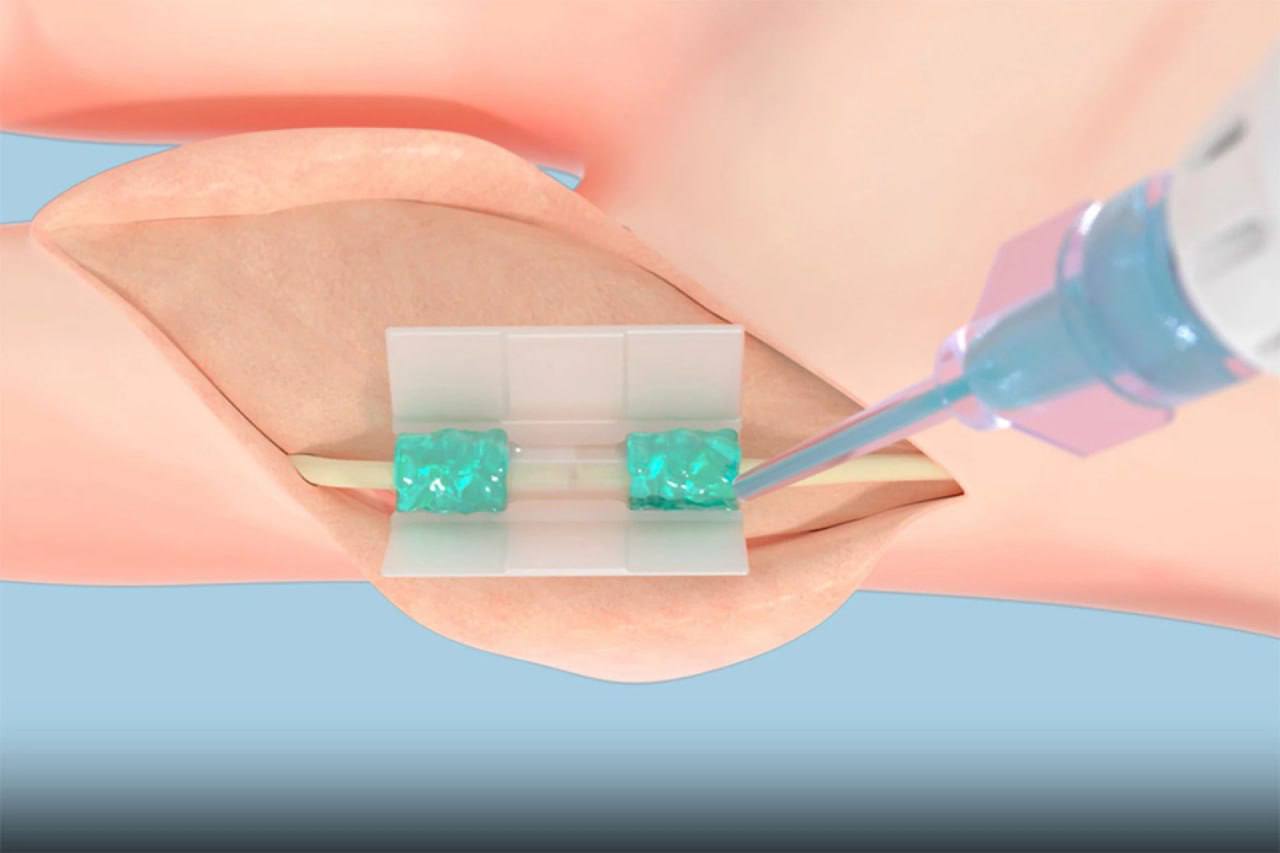 Erekshe emdeý ádisi