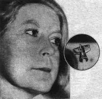 Ǵalamsharlyqtar ornatqan ımplant