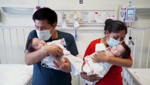 Perý dárigerleri sıam egizderin ajyratty