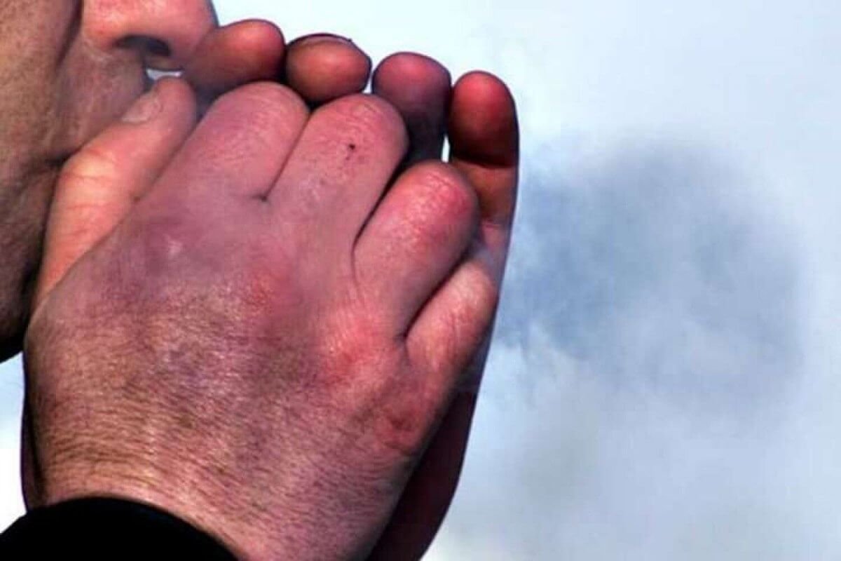 Qostanaıda jyl basynan beri 20 adamdy úsik shalǵan