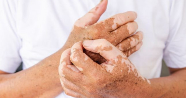 Qazaqstanda sońǵy segiz jylda alapes juqtyrǵandar tirkelmegen