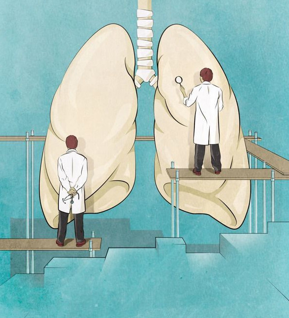 Qazaqstanda týberkýlezden bolatyn ólim-jitim 10%-ǵa azaıǵan