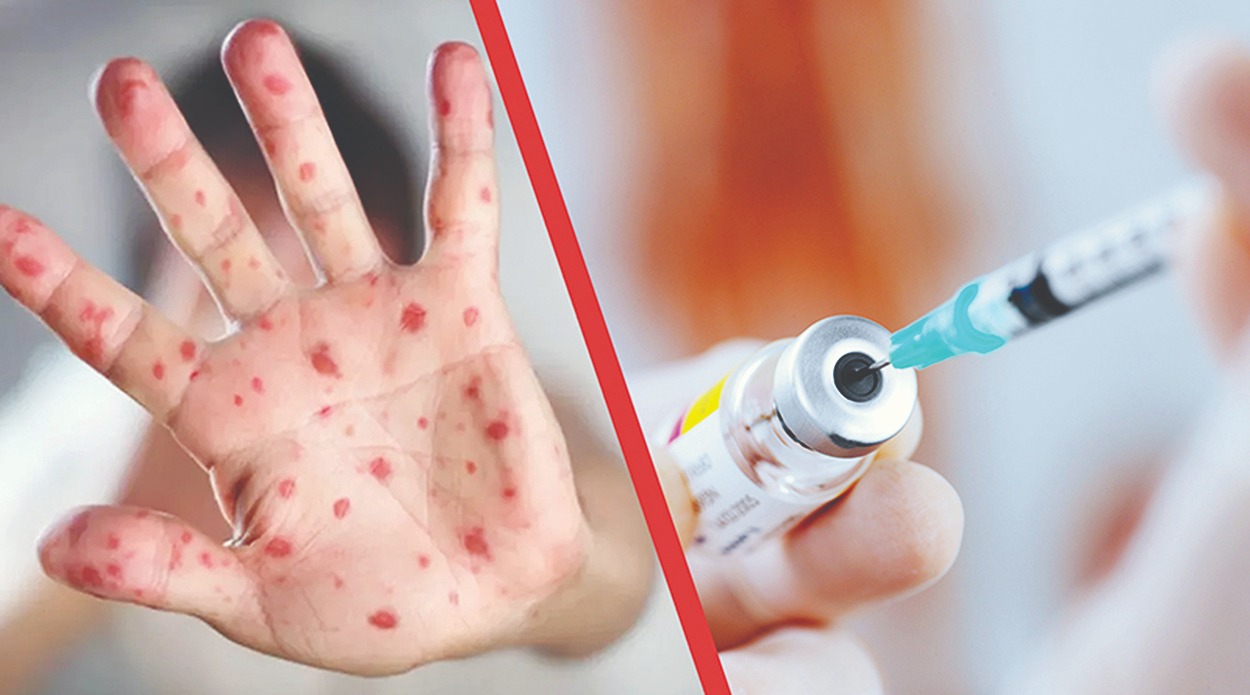 Elimizde qyzylshaǵa qarsy vaksınasııa naýqany toqtady ma?