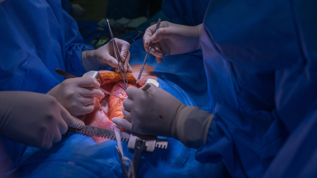 Elimizde alǵash ret 15 jastaǵy balaǵa júrek transplantasııasy jasaldy