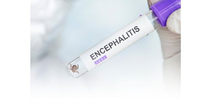 Kene ensefalıtinen qalaı qorǵaný kerek?