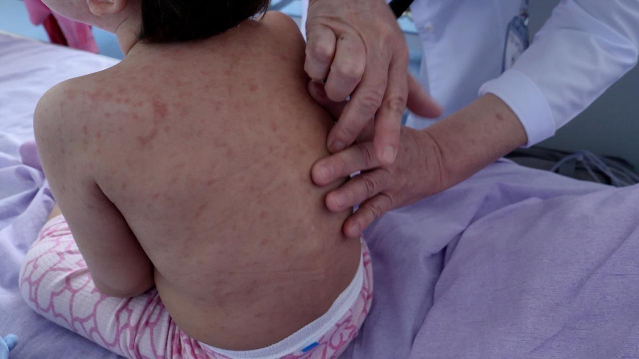 Elimizde qyzylsha juqtyrý kórsetkishi 30%-ǵa tómendedi