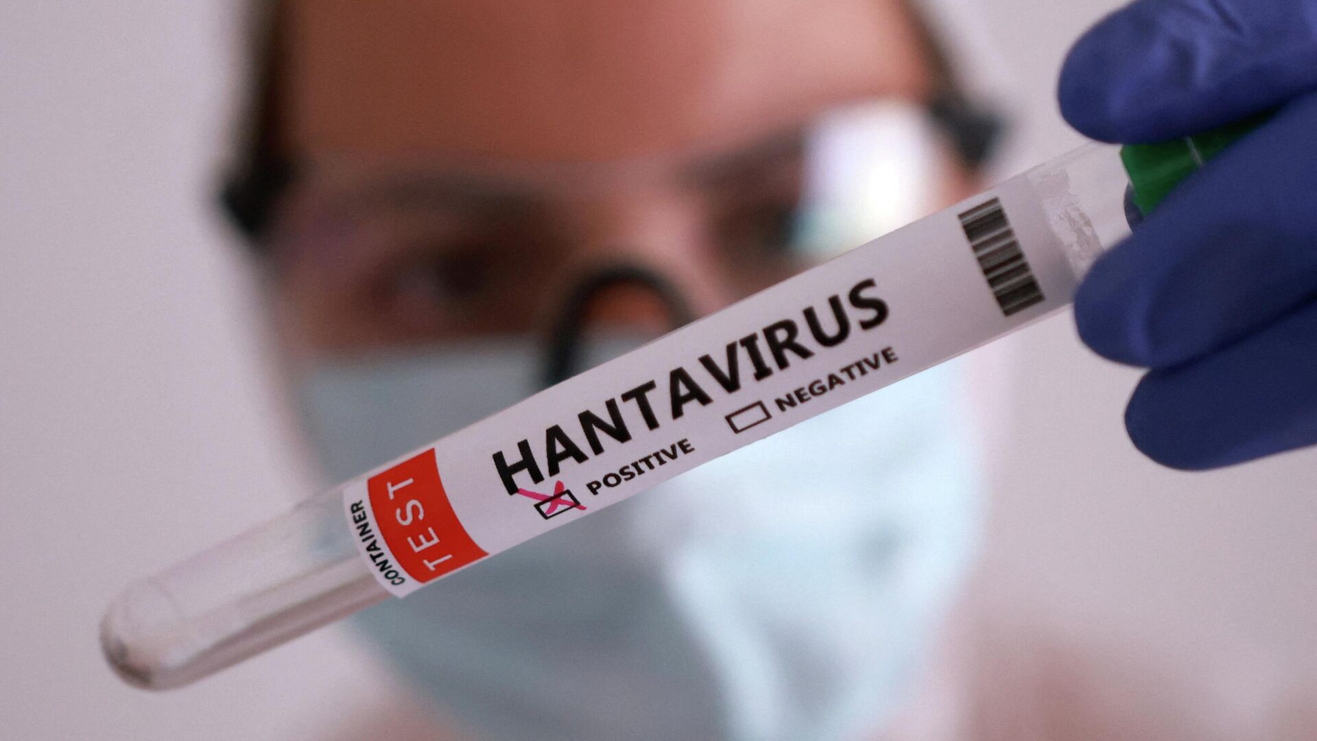 Kemirgishterden keletin qaýip: Hantavırýstyń alǵashqy belgileri qandaı?